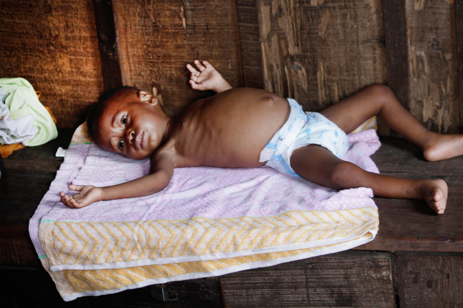 The Plight of an Indigent Child