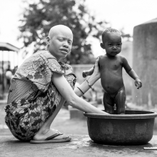 Albinos Africa, ghost people.